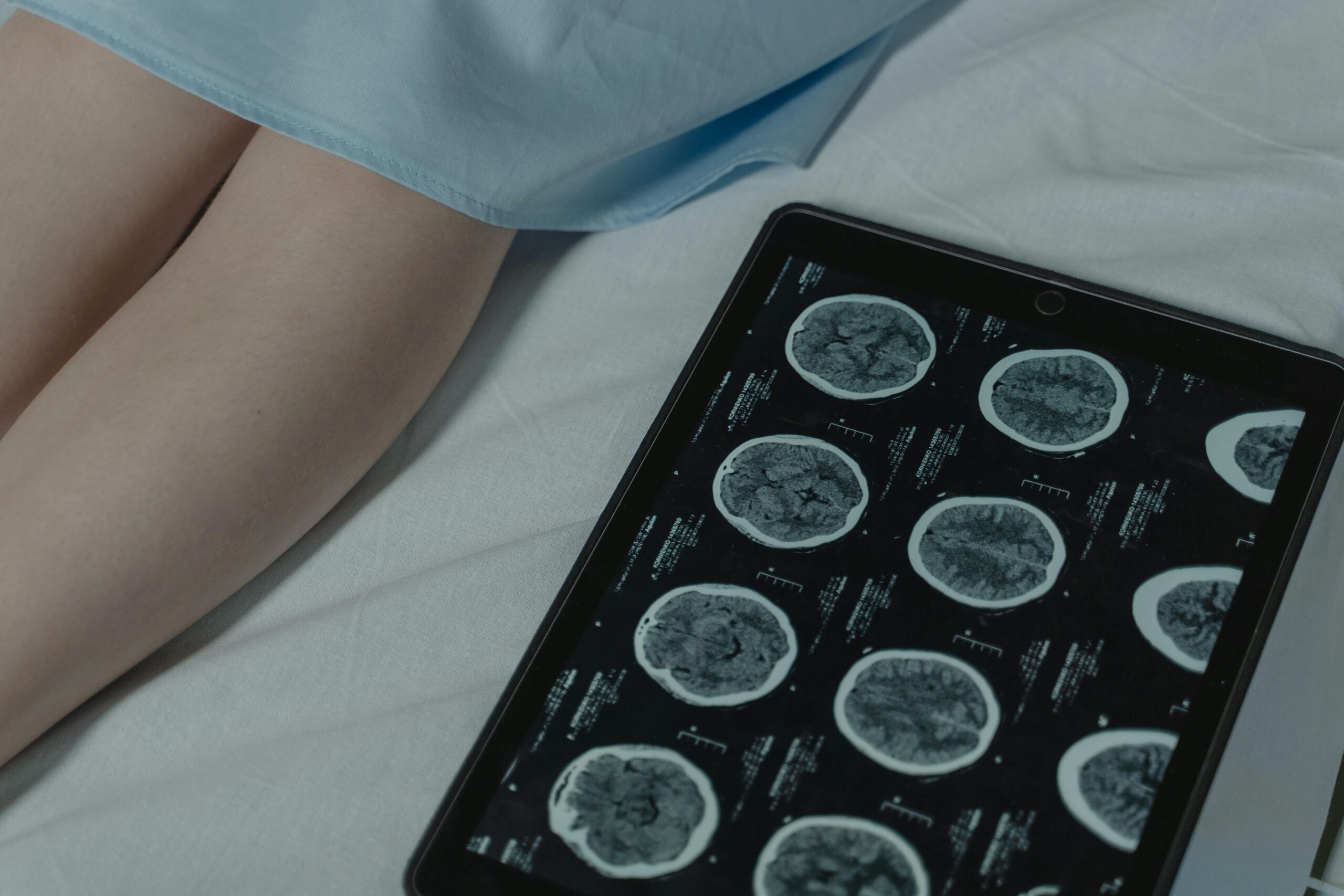 Home Neurologist providing specialized neurological care at a physiotherapy center in Tohana