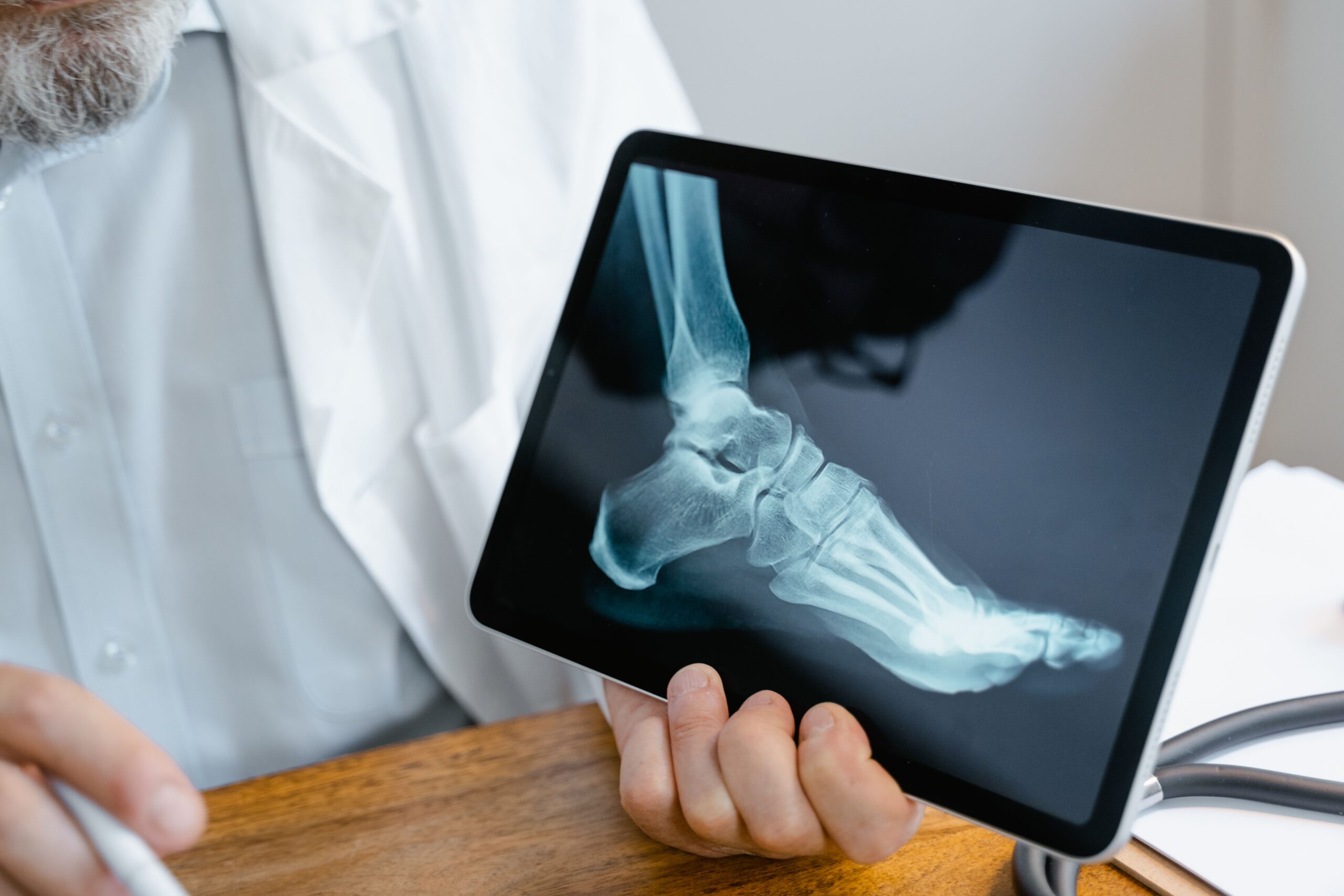 Home Physiotherapist explaining a foot fracture diagnosis to a patient at a physiotherapy center in Tohana